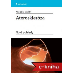 Ateroskleróza: Nové pohledy - Aleš Žák, kolektiv a [E-kniha]