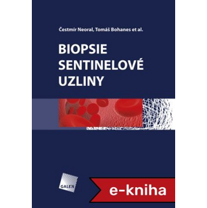 Biopsie sentinelové uzliny - Čestmír Neoral, Tomáš Bohanes [E-kniha]