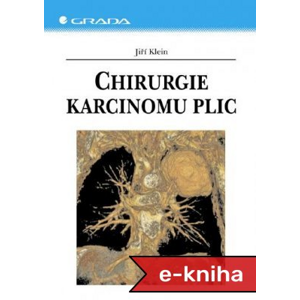 Chirurgie karcinomu plic - Jiří Klein [E-kniha]