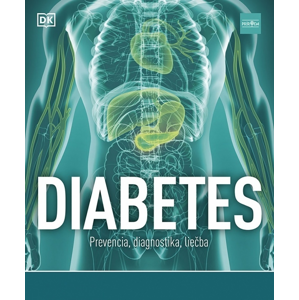 Diabetes Prevencia, diagnostika, liečba -  Rosemary Walker