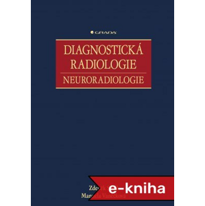 Diagnostická radiologie: Neuroradiologie - Zdeněk Seidl, Manuela Vaněčková [E-kniha]