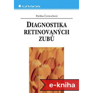 Diagnostika retinovaných zubů - Pavlína Černochová [E-kniha]