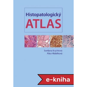 Histopatologický atlas - Svetlana Brychtová, Alice Hlobilková [E-kniha]
