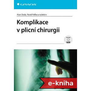 Komplikace v plicní chirurgii - Alan Stolz, Pavel Pafko, kolektiv a [E-kniha]