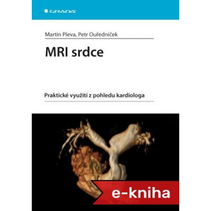 MRI srdce: Praktické využití z pohledu kardiologa - Martin Pleva, Petr Ouředníček [E-kniha]