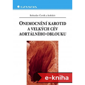 Onemocnění karotid a velkých cév aortálního oblouku - Bohuslav Čertík, kolektiv a [E-kniha]