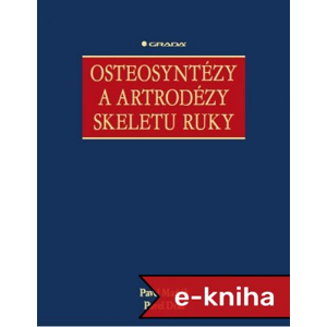 Osteosyntézy a artrodézy skeletu ruky - Pavel Maňák, Pavel Dráč [E-kniha]