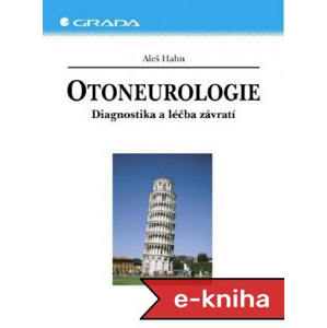 Otoneurologie: Diagnostika a léčba závratí - Aleš Hahn [E-kniha]
