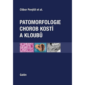 Patomorfologie chorob kostí a kloubů - Ctibor Povýšil [kniha]