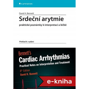 Srdeční arytmie praktické poznámky k interpretaci a léčbě: Překlad 8. vydání - David H. Bennett [E-kniha]